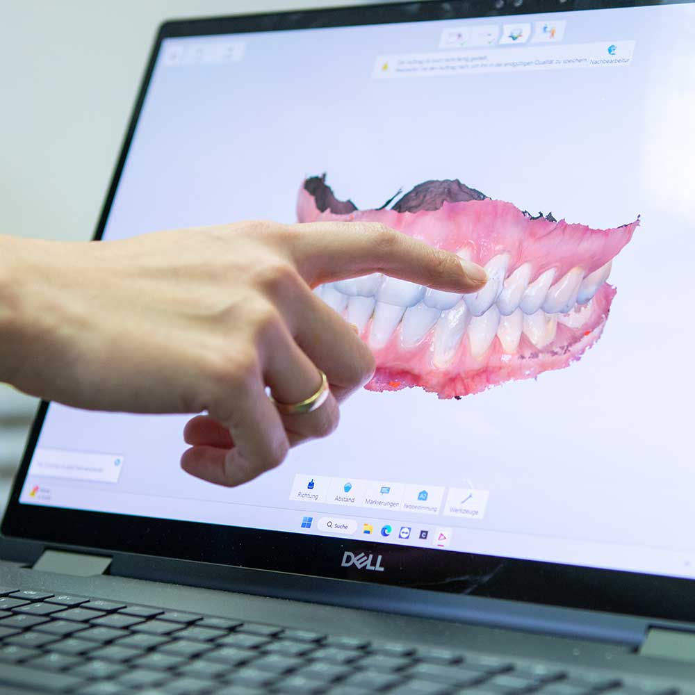 cerec_dus
